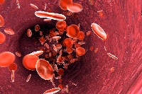 Monosaccharides,reperfusion injury post ischemia 